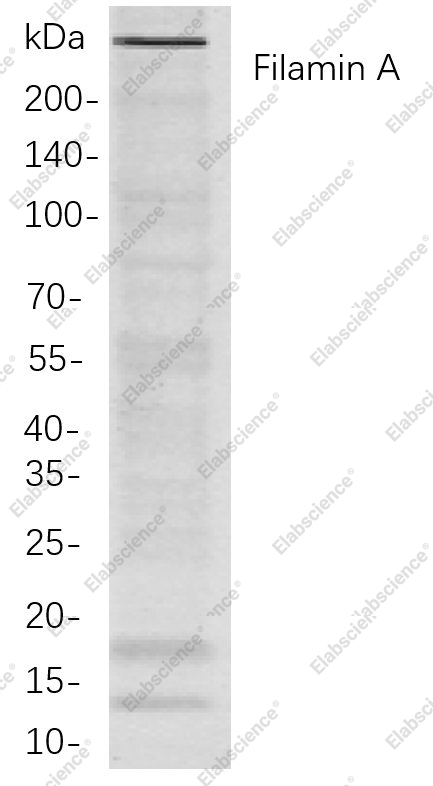 Recombinant Filamin A Monoclonal Antibody - 1