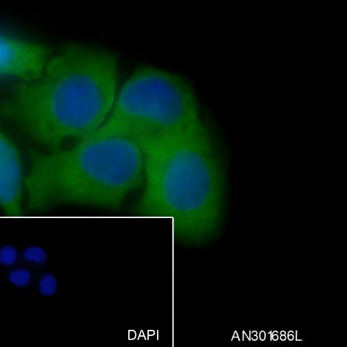 Recombinant Vitronectin/S-Protein Monoclonal Antibody - small - 4