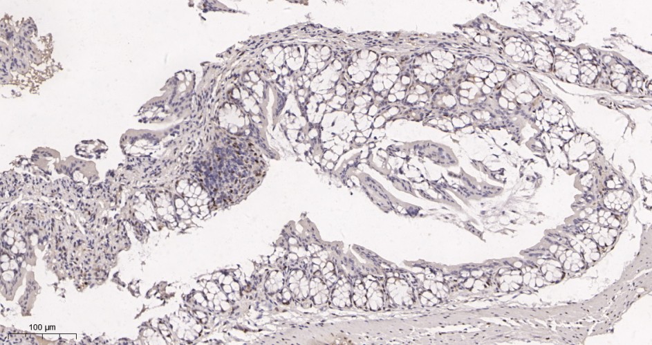 Recombinant Cyclin D1 Monoclonal Antibody - small - 3