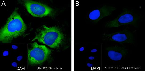 Recombinant Phospho-S6 Ribosomal Protein (Ser240, 244) Monoclonal Antibody - small - 7