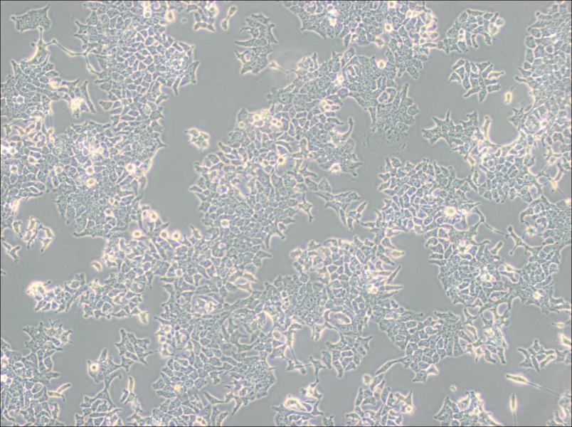 H-4-II-E [H4-II-E] Cell Complete Medium - 3