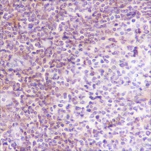 Recombinant VPAC2 Monoclonal Antibody - 1