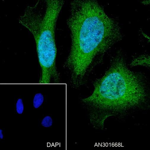 Recombinant SOD1 Monoclonal Antibody - small - 5