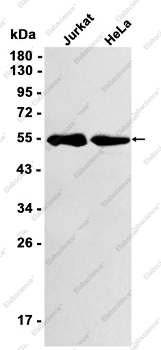 Recombinant GPC1 Monoclonal Antibody - 1