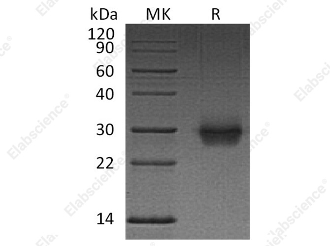 Recombinant Human CD40/TNFRSF5 Protein (His Tag) - 1