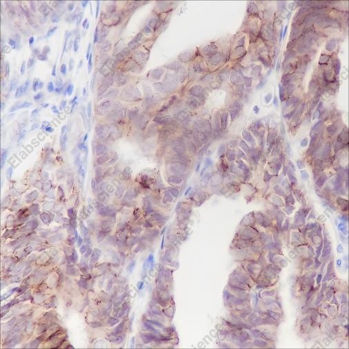 Recombinant Claudin-7 Monoclonal Antibody - 4