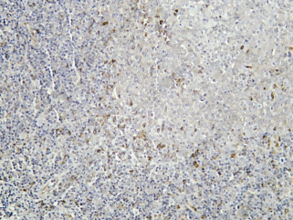 Recombinant PODXL Monoclonal Antibody - 2