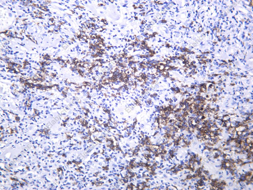 Recombinant Keratin 20 Monoclonal Antibody - 2