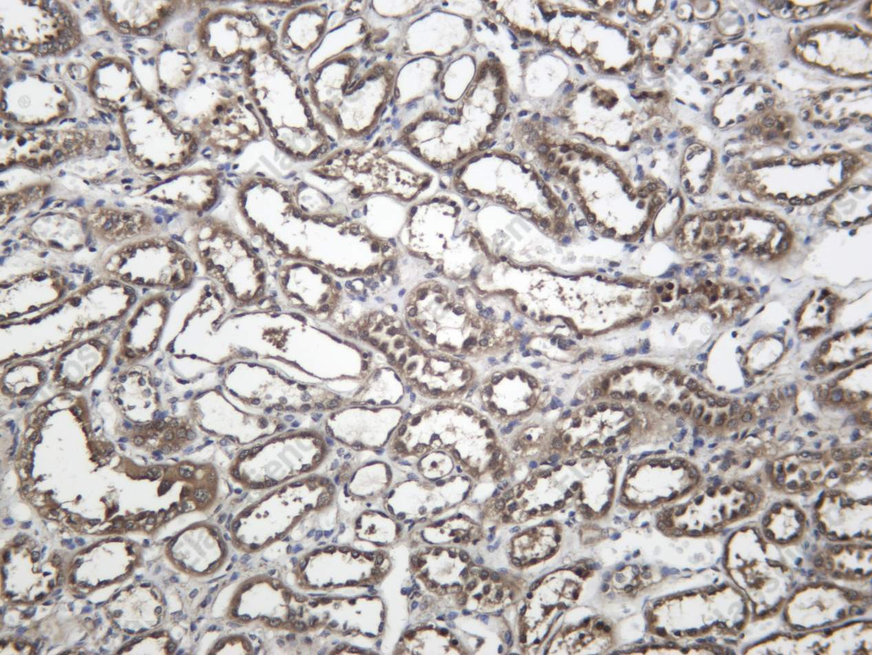 Recombinant VPRBP Monoclonal Antibody - 1