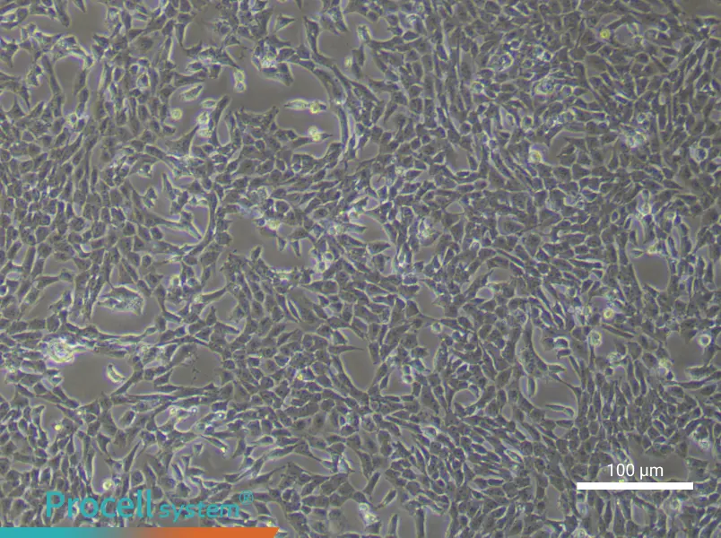 Mouse Pulmonary Artery Endothelial Cells (Primary cell immortalization)Mouse Pulmonary Artery Endothelial Cells (Primary cell immortalization) - 1