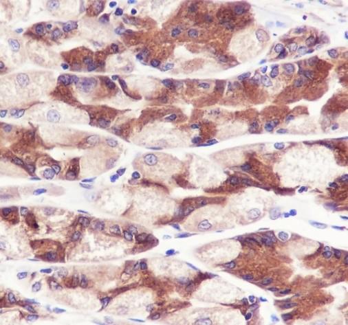 Recombinant PGRMC2 Monoclonal Antibody - small - 3