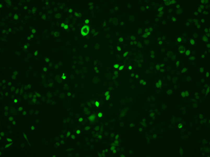 AGS-LUC-EGFP Cell Complete Medium - 3