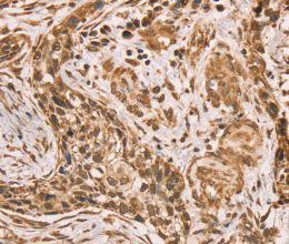 HIF1AN Polyclonal Antibody - 2