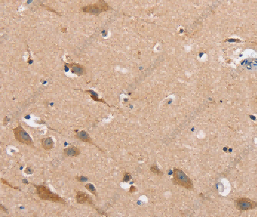MSMB Polyclonal Antibody - 3
