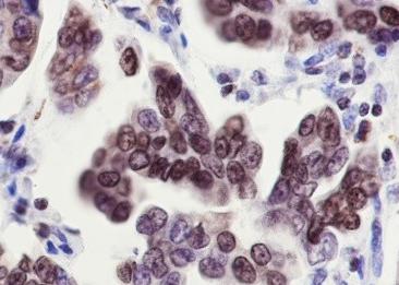 Recombinant PLAG1 Monoclonal Antibody-searchlist-3