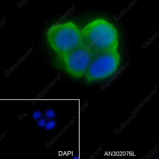 Recombinant Phospho-S6 Ribosomal Protein (Ser235, Ser236) Monoclonal Antibody - 4