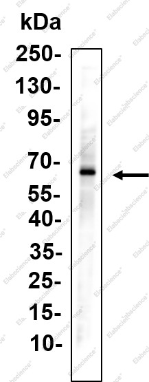 Recombinant G6PD Monoclonal Antibody - 1