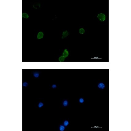 Recombinant IFITM1 Monoclonal Antibody - 3