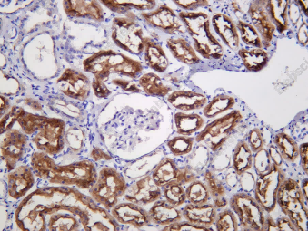 Recombinant FOLR1 Monoclonal Antibody - 1