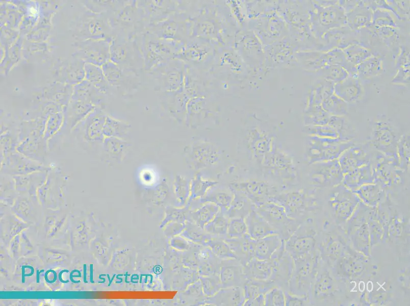HCC-44 Cell Complete Medium - 5