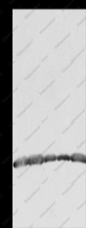 PRDX3 Polyclonal Antibody - 1