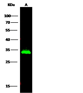 Recombinant HNMT Monoclonal Antibody - small - 2