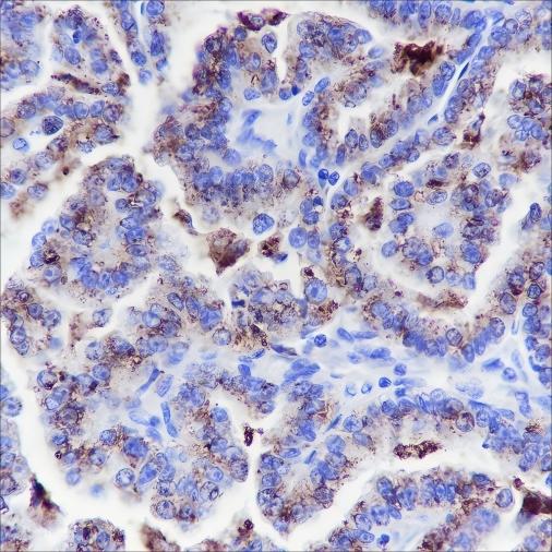 Recombinant Napsin A Monoclonal Antibody - 2