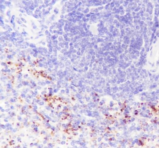 Recombinant TGF beta 1 Monoclonal Antibody-searchlist-2