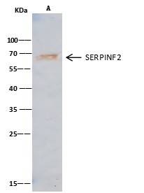 Recombinant SerpinF2 Monoclonal Antibody - small - 2
