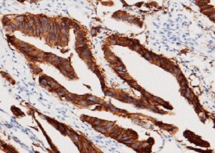 Recombinant EpCAM/TROP-1/TACSTD1 Monoclonal Antibody - small - 3