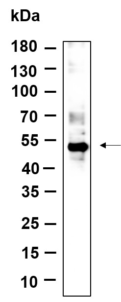 Recombinant Phospho-p53 (Ser46) Monoclonal Antibody-searchlist-1