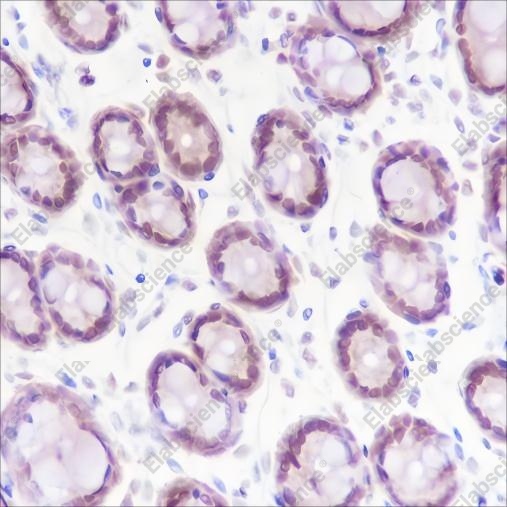 Recombinant KDM2A Monoclonal Antibody - 2