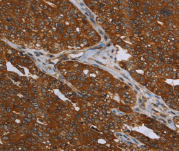 MCHR1 Polyclonal Antibody - 2