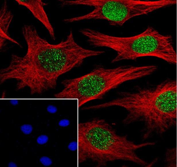 Recombinant Histone H3 (CT) Monoclonal Antibody - 3