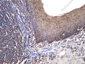 Recombinant Cytokeratin 4 Monoclonal Antibody - 1