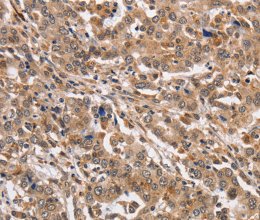 KCNG2 Polyclonal Antibody - 3