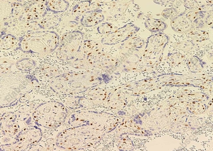 PARP/PARP1 Monoclonal Antibody - 2