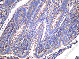 Recombinant ALDH1A2 Monoclonal Antibody - 1
