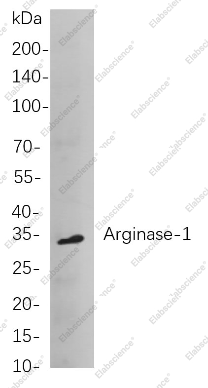 Recombinant Arginase-1 Monoclonal Antibody - 1