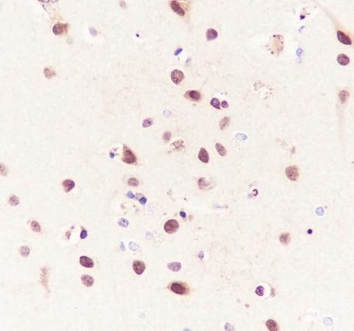 Recombinant CBX4 Monoclonal Antibody - small - 4