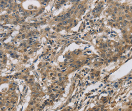 DHRS3 Polyclonal Antibody - 2
