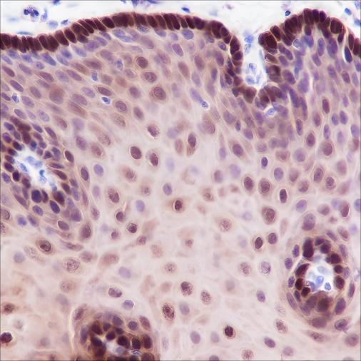 Recombinant ALDH3A1 Monoclonal Antibody - 2