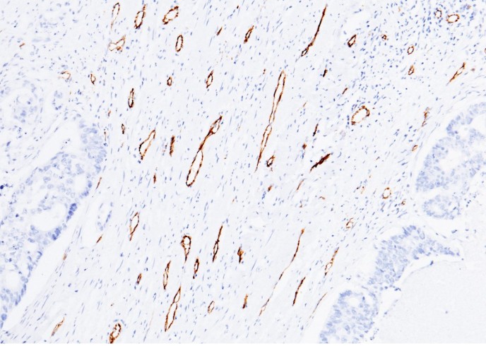 Recombinant CD31/PECAM1 Monoclonal Antibody-searchlist-1