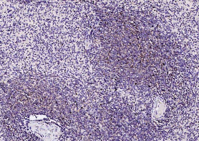 PD1/PDCD1/CD279 Monoclonal Antibody - small - 2