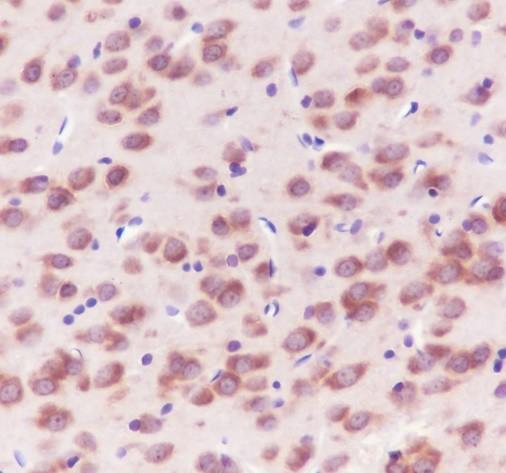 Recombinant 14-3-3 gamma Monoclonal Antibody - small - 3