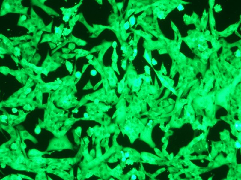 NCI-H446-GFP Cell Complete Medium - small - 6