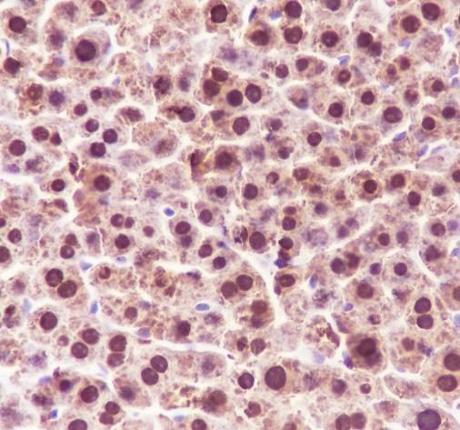 Recombinant ADK Monoclonal Antibody - small - 4