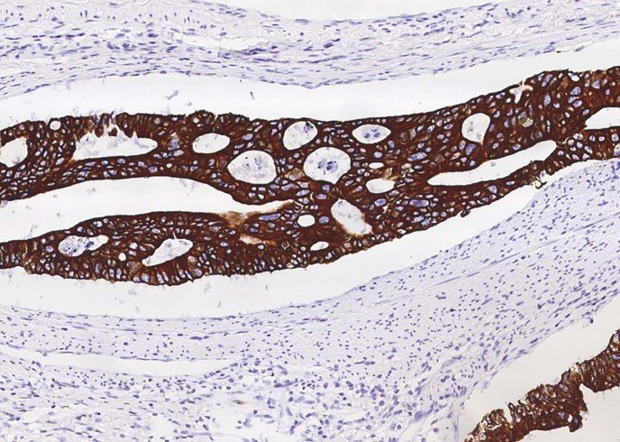 Cytokeratin 8 Monoclonal Antibody - small - 3