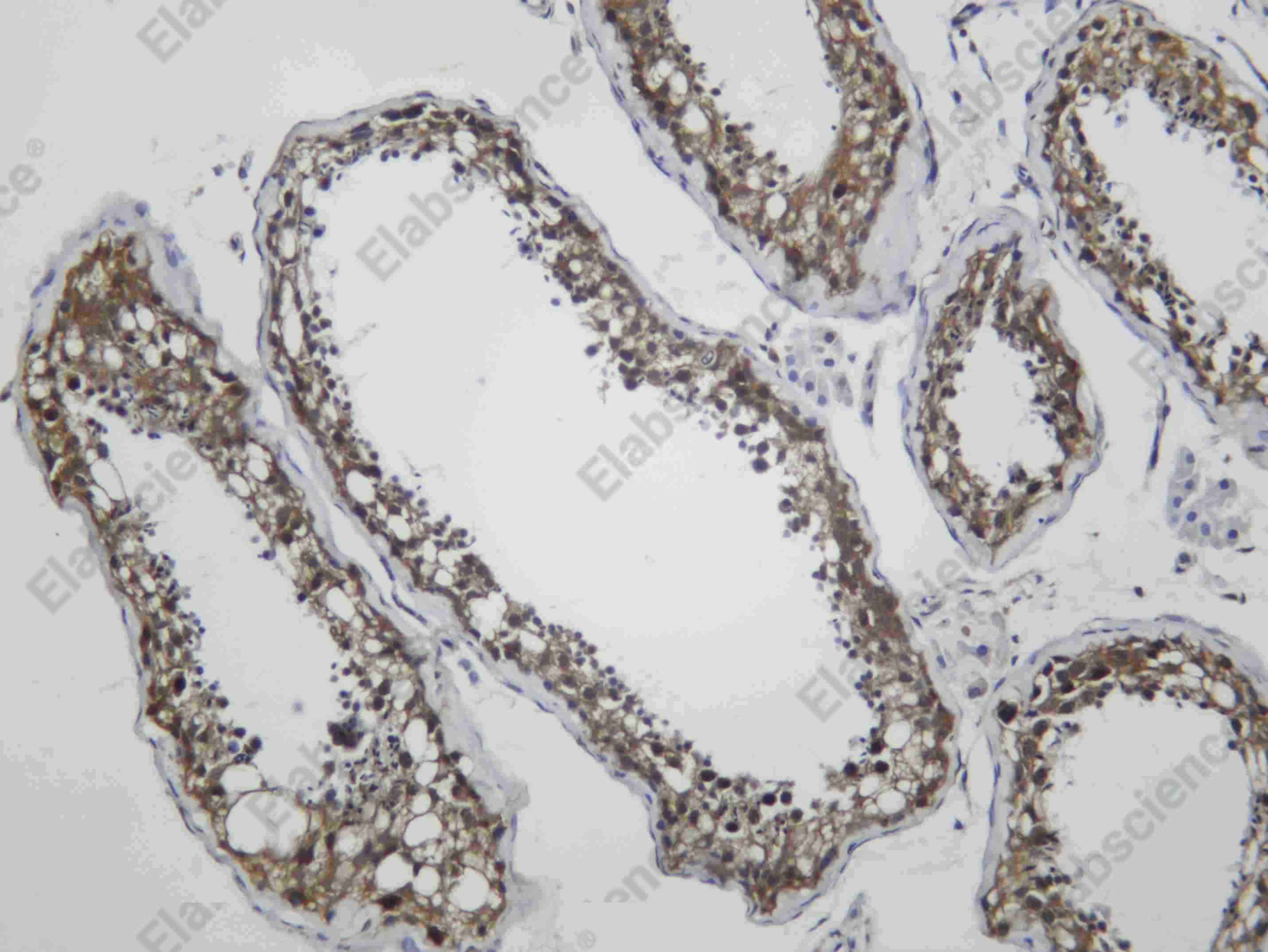 Recombinant Huntingtin Monoclonal Antibody - 2