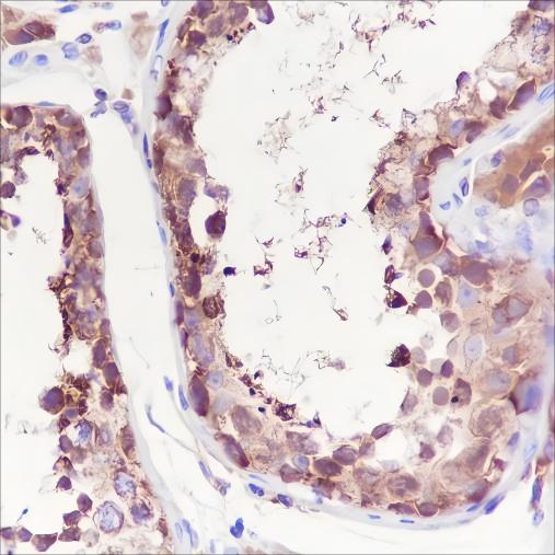 Recombinant LysRS Monoclonal Antibody - small - 2